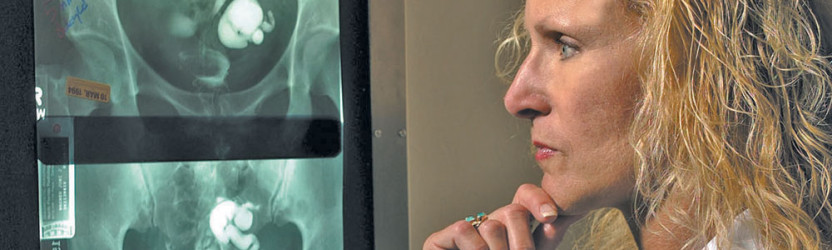 HSG Komplikasyonları Nelerdir?